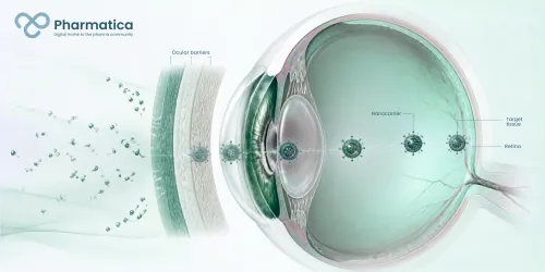 Pharmatica visual showing nanocarrier-based ocular drug delivery overcoming eye barriers to target deeper ocular tissues and the retina.